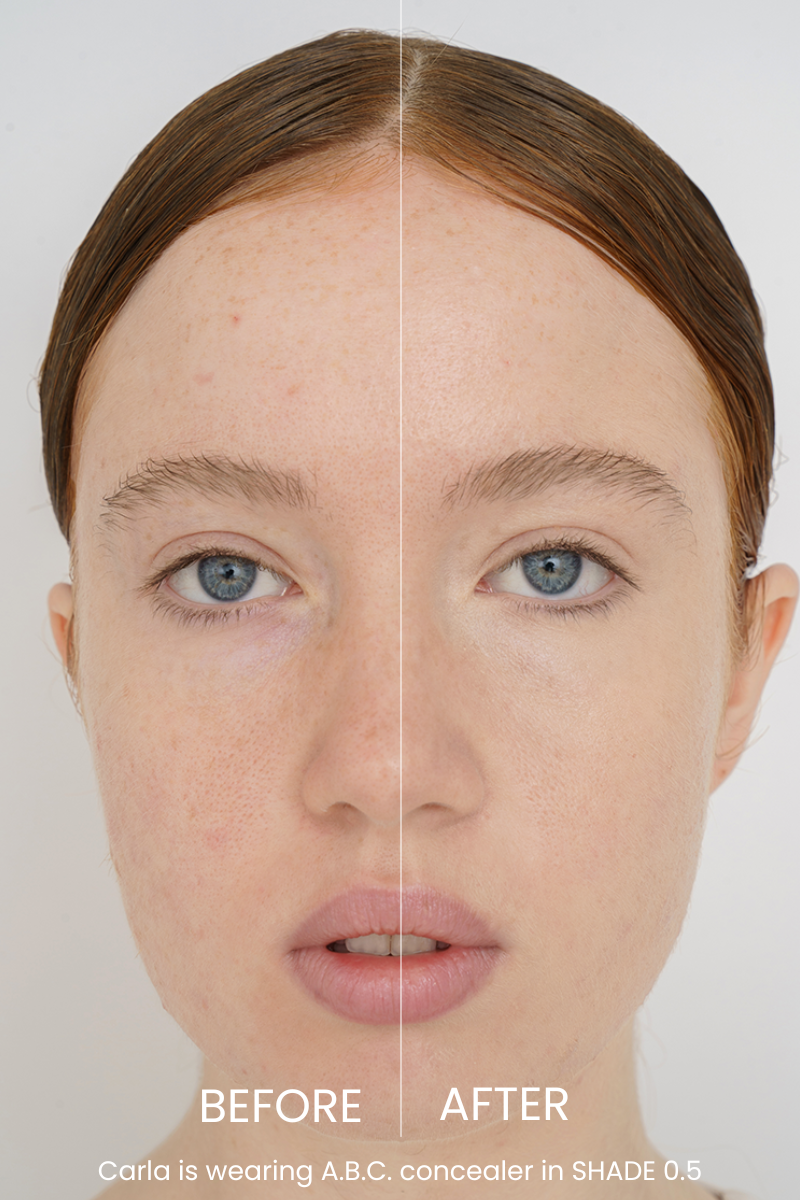The ABC Concealer