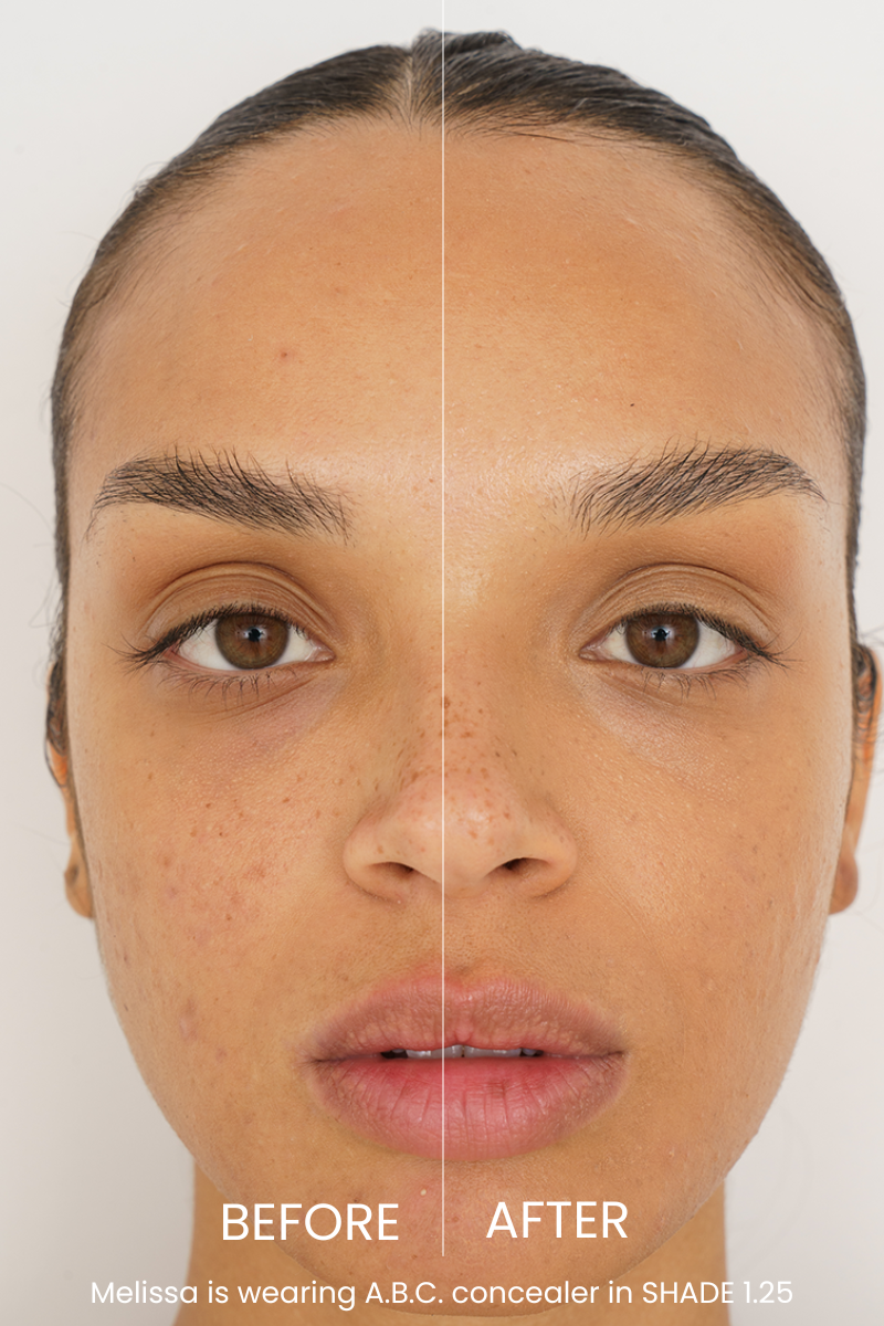 The ABC Concealer