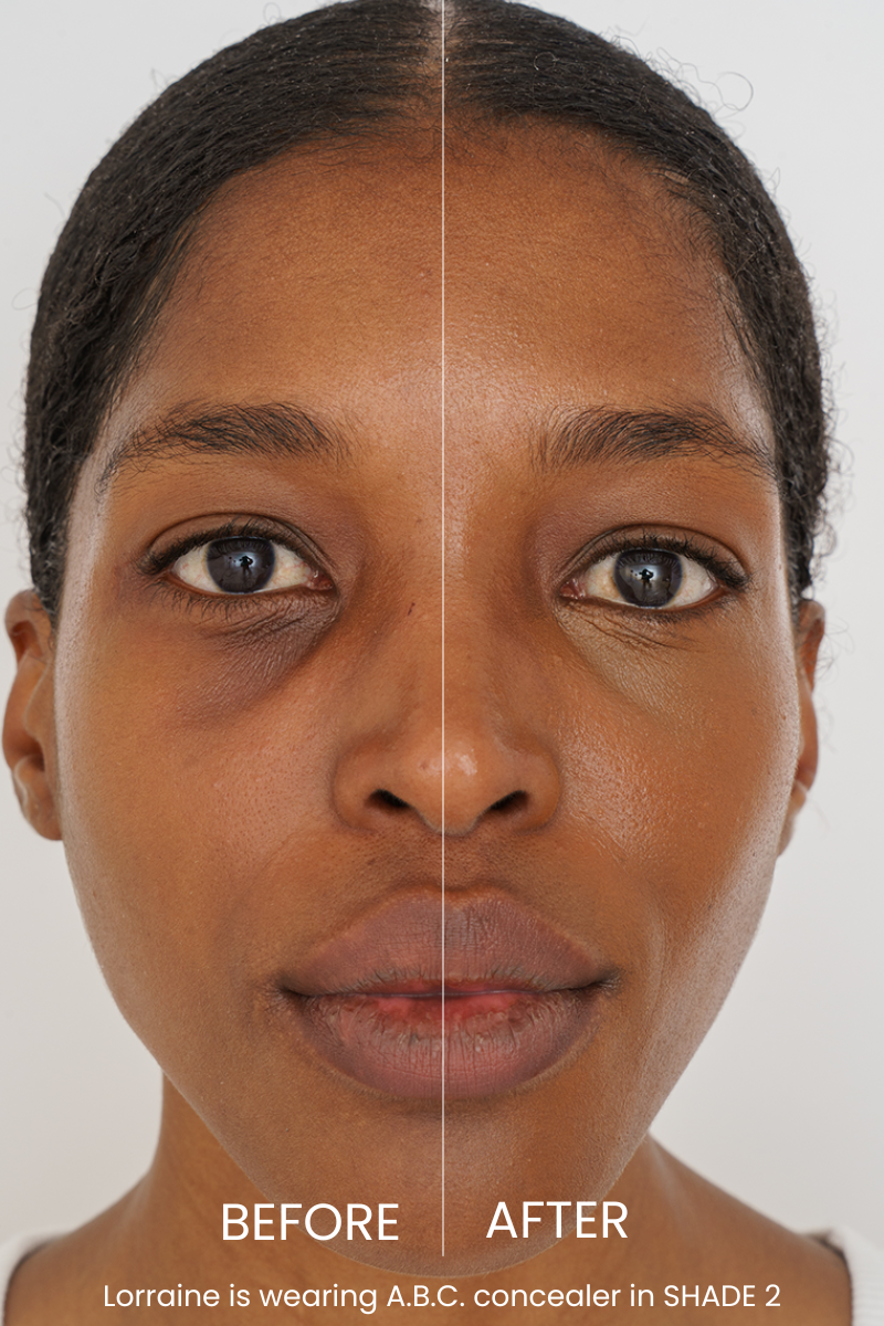The ABC Concealer
