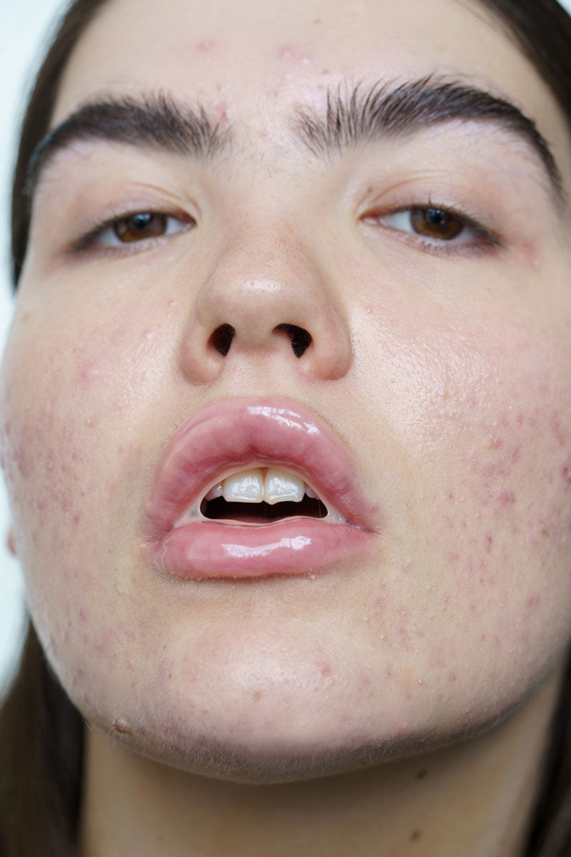 LIP-ME nourishing lip mask